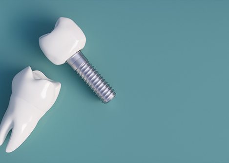 dental implants against a grey background